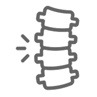 Herniated or Bulging Discs